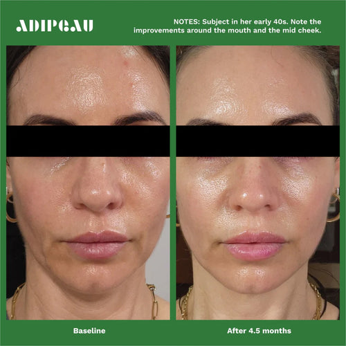 Adipeau Volume Cream (60ml)