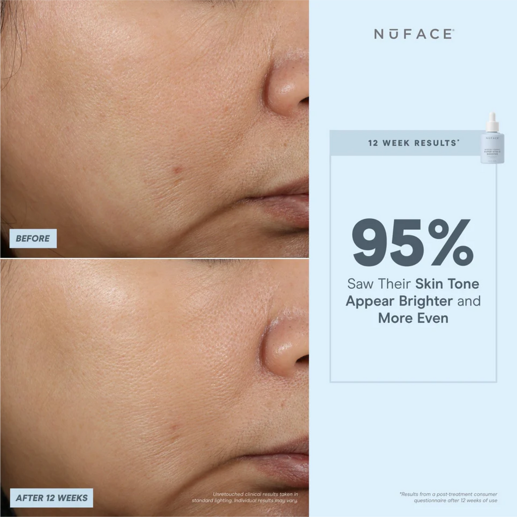 NuFACE Super Vita-C Booster Serum 5mL