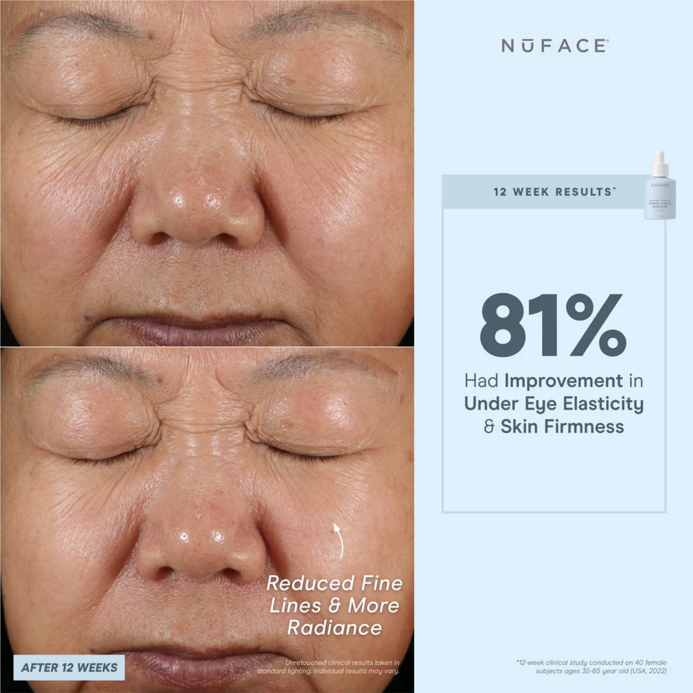 NuFACE Super Vita-C Booster Serum 5mL