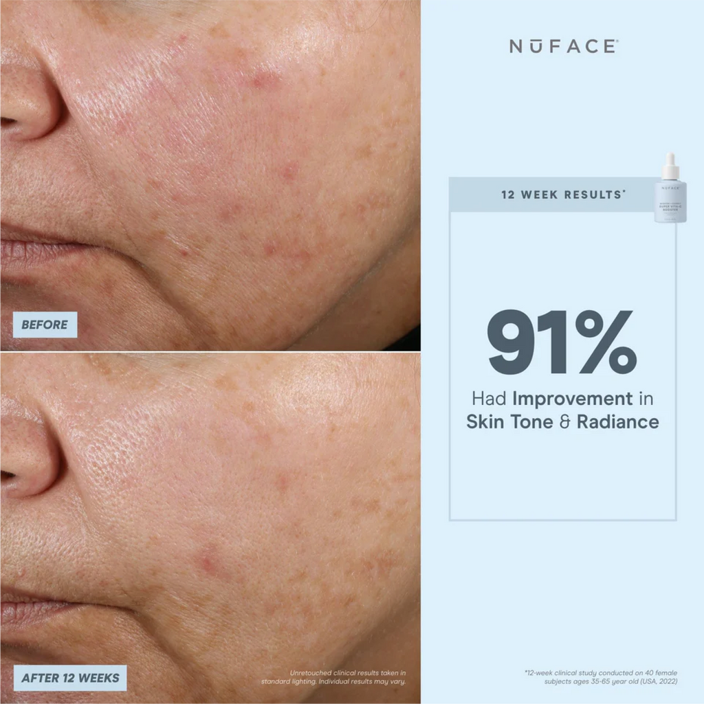 NuFACE Super Vita-C Booster Serum