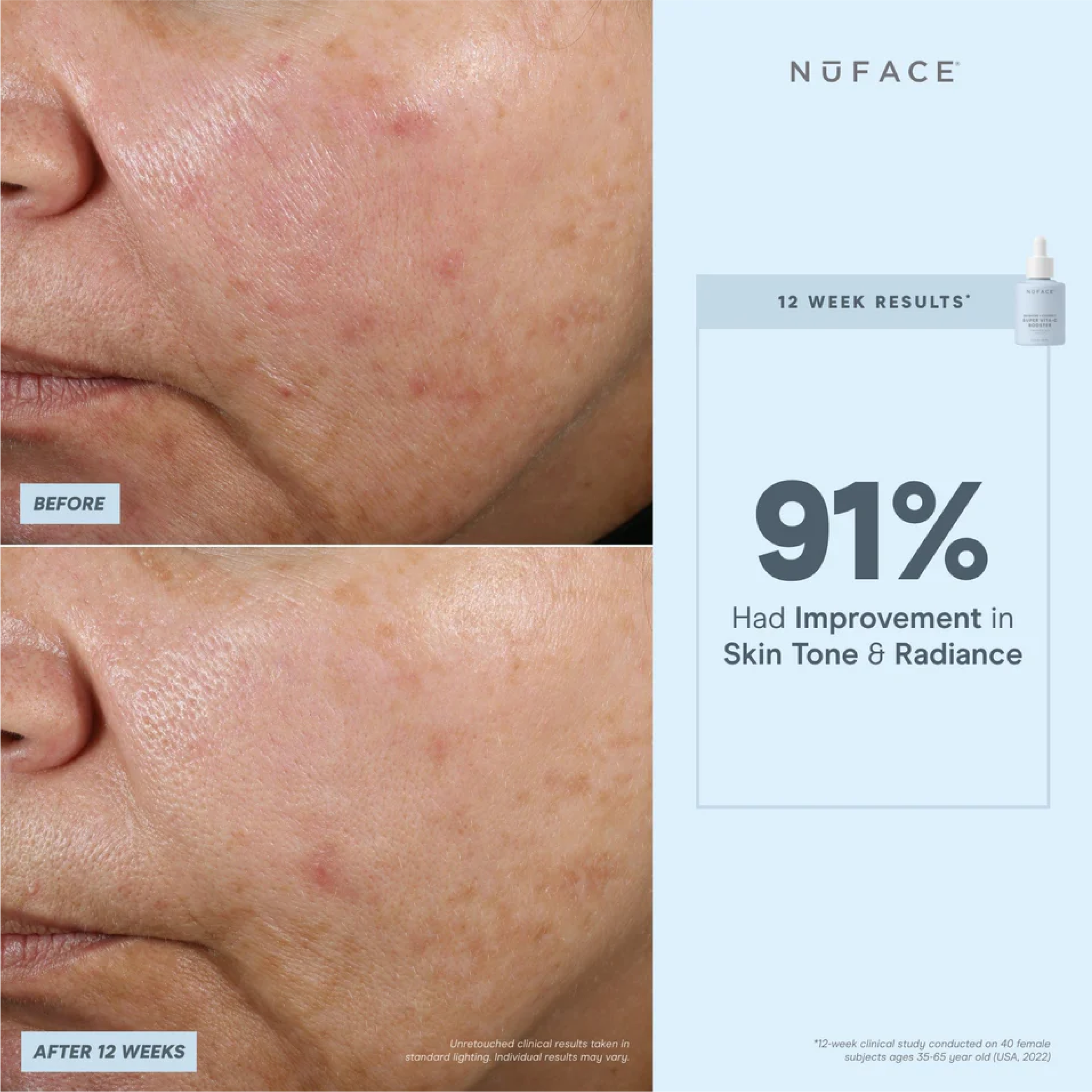 NuFACE Super Vita-C Booster Serum