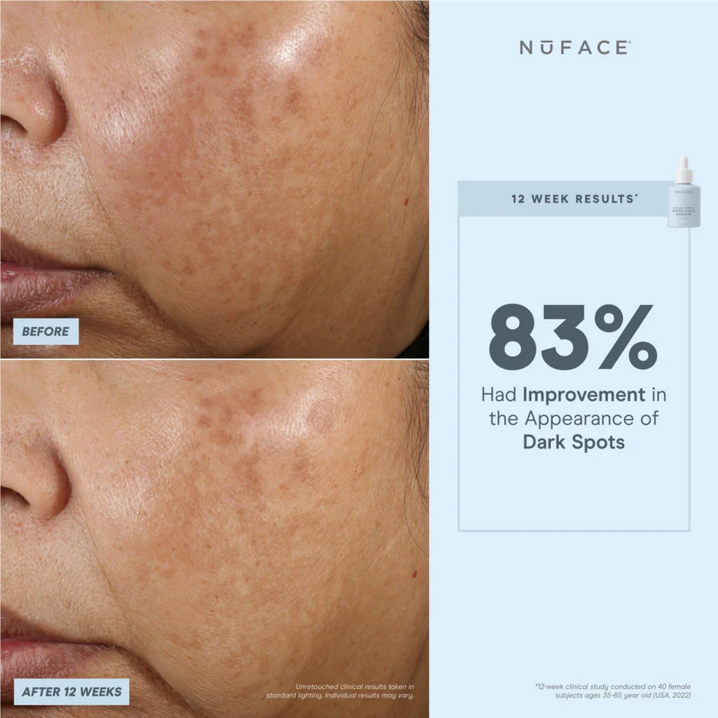 NuFACE Super Vita-C Booster Serum 5mL
