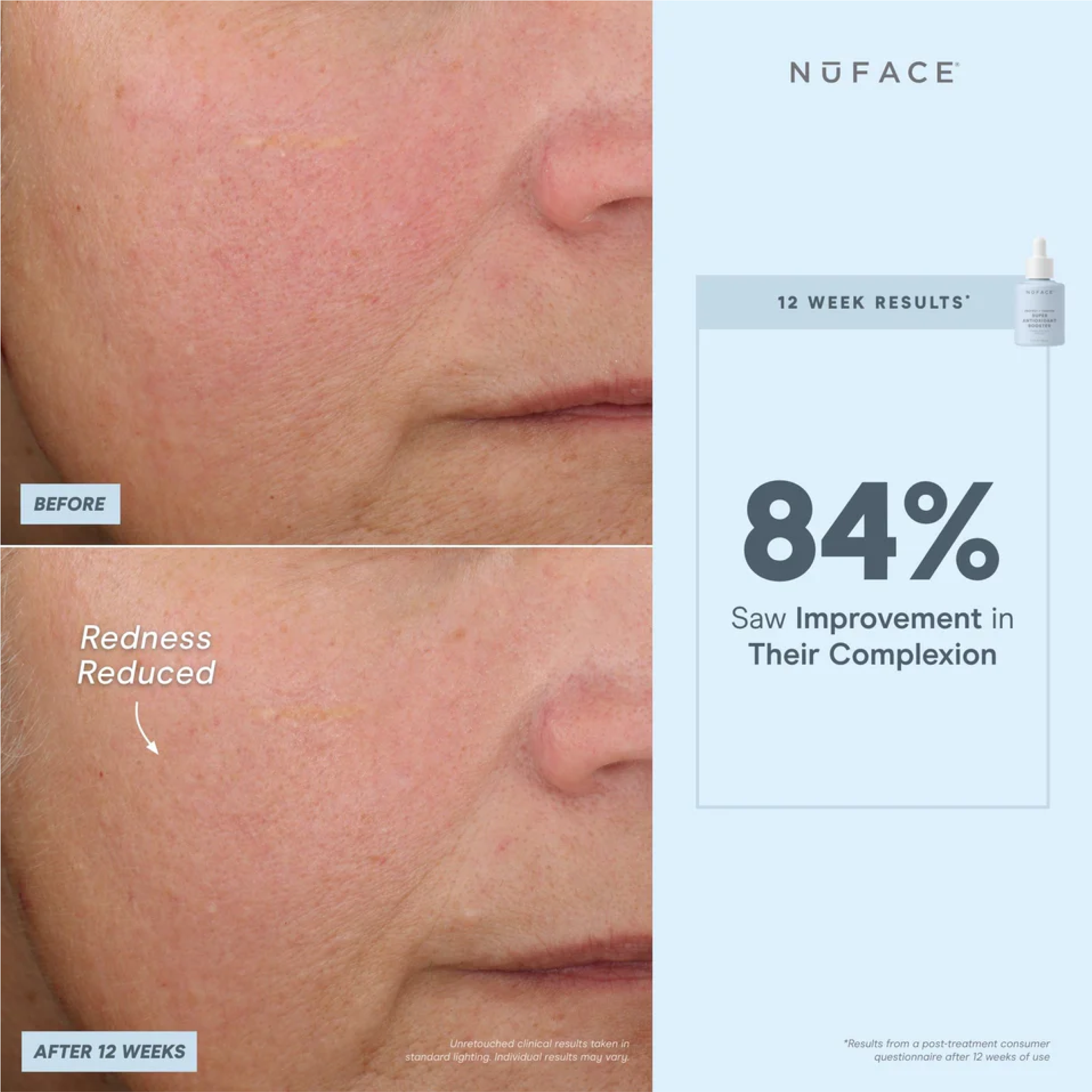 NuFACE Super Antioxidant Booster Serum