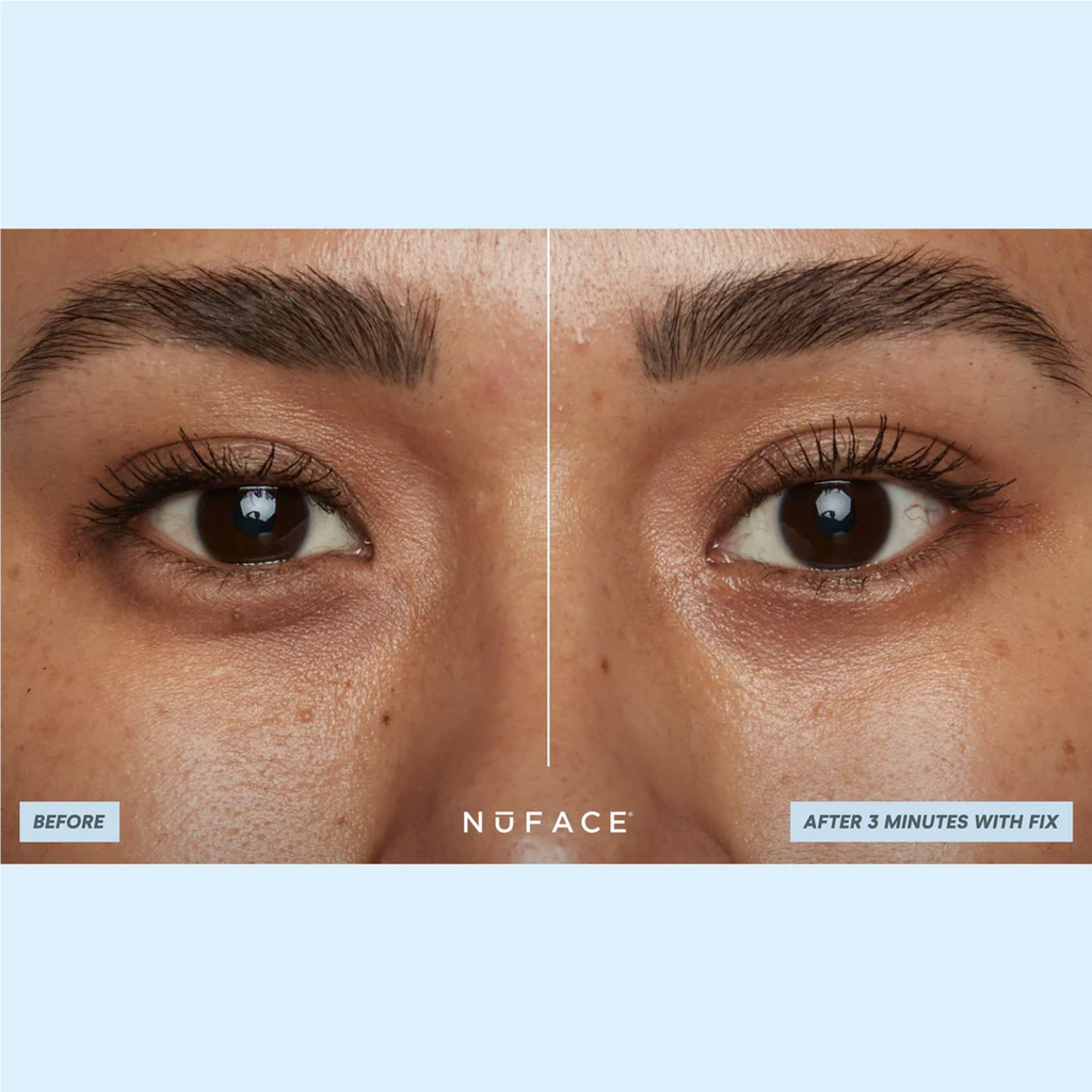 NuFACE IonPlex® Hydra-Gel Power Patches