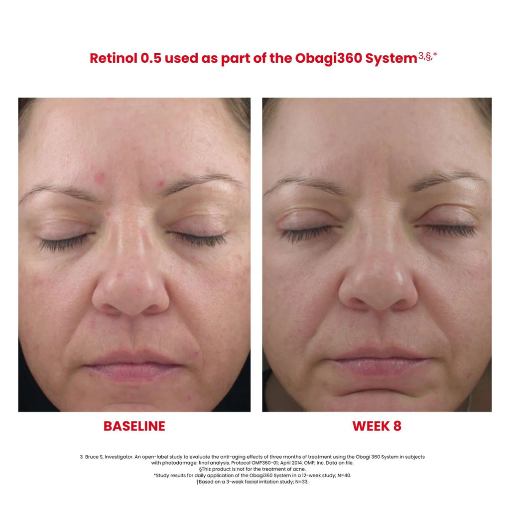 Obagi360® Smoothing Retinol 0.5