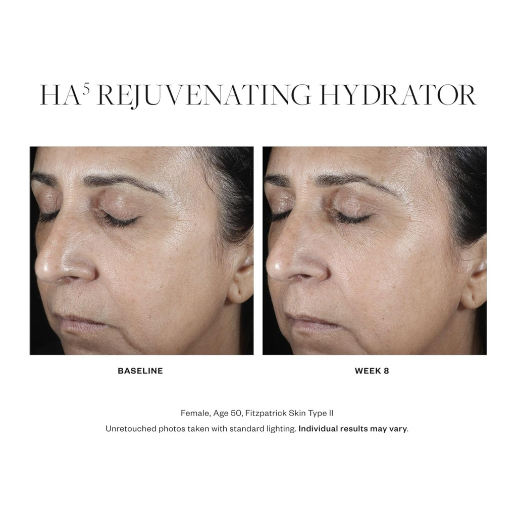 SkinMedica HA5® Rejuvenating Hydrator