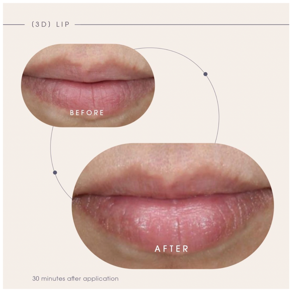 Teoxane [3D] Lip, Nourishing & Plumping Lip Care