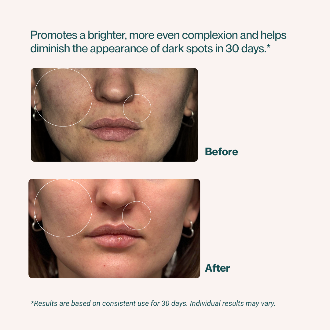 NiaBoost Radiance Serum