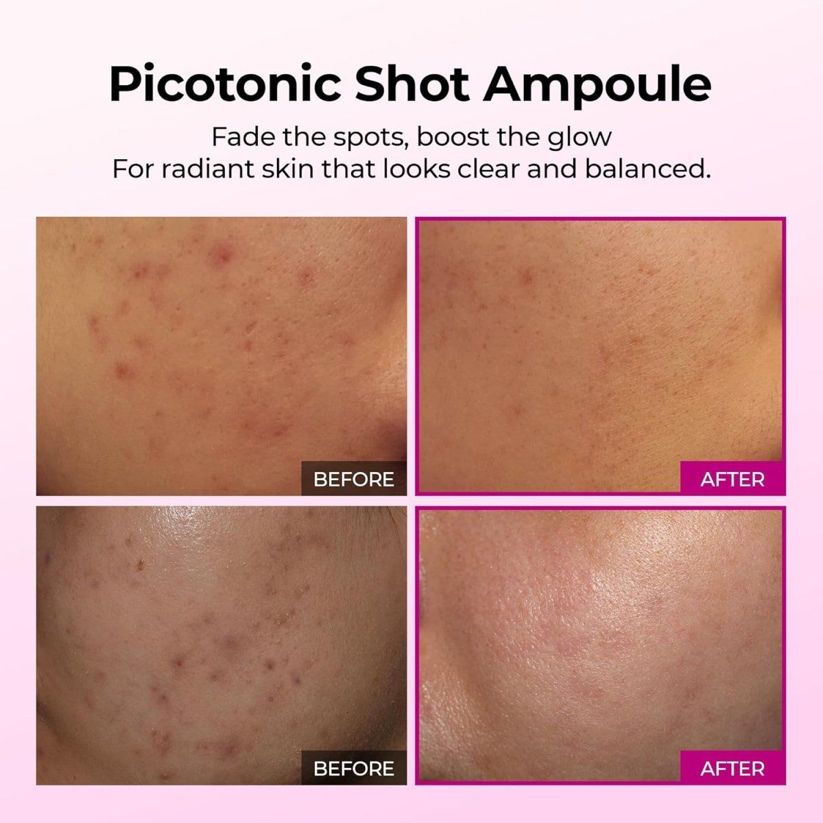Dr.Melaxin Cemenrete Picotonic Shot Ampoule 30ml