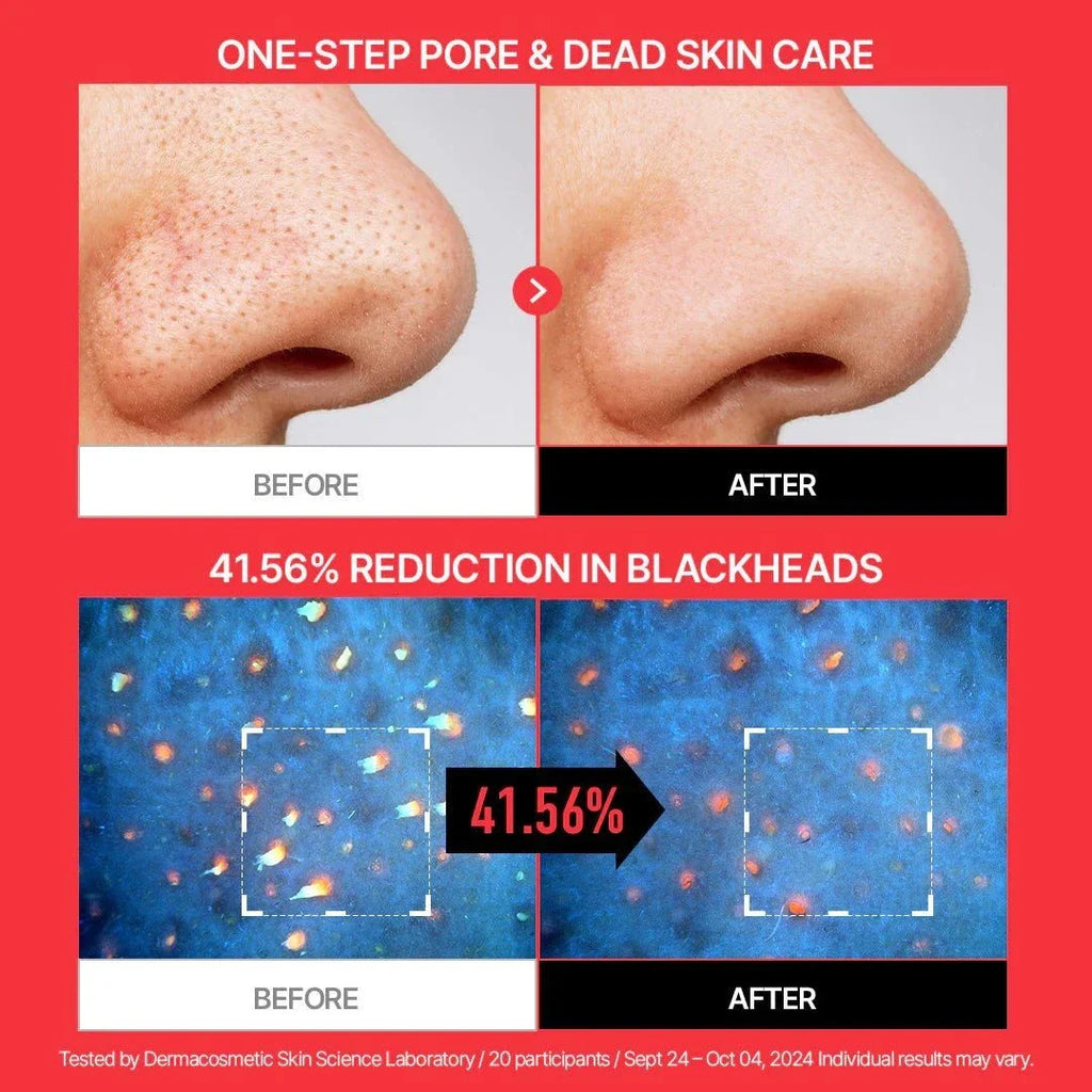 Parnell AHA Omija Ceramic Bubble Peeling Cleanser 180ml